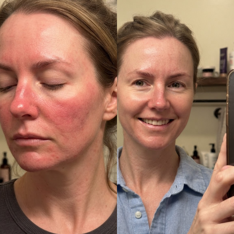 1. Calms the Look of Redness and Irritation