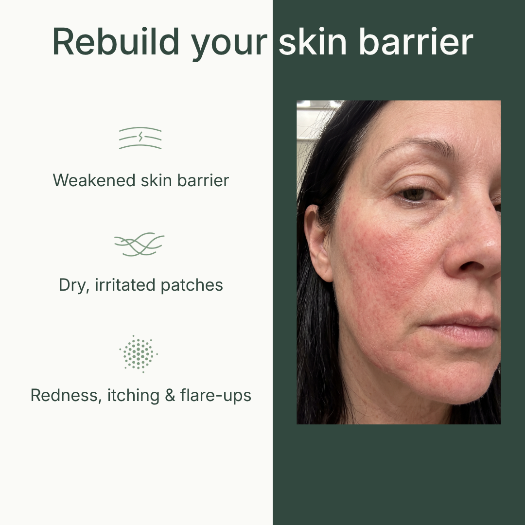 Taloe Face Balm