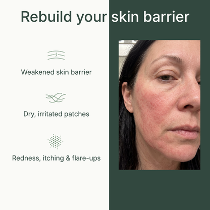 Taloe Face Balm